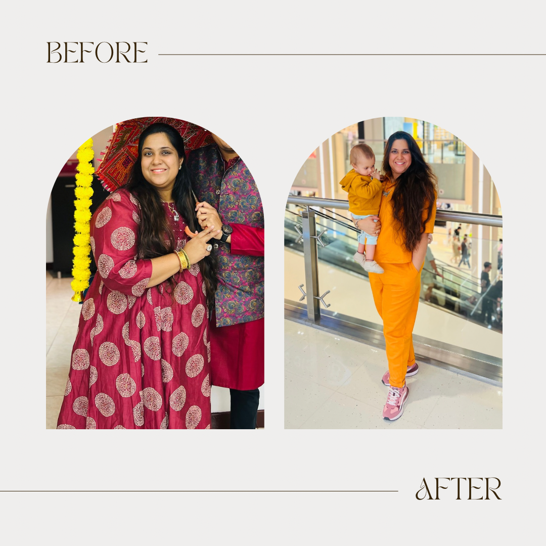Shefali — her own before and after